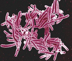 Figure 1: Mycobacterium tuberculosis bacteria, the cause of TB